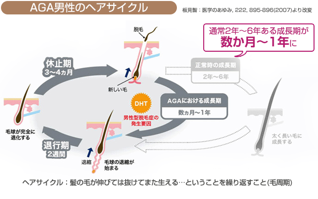 AGA男性のヘアサイクルのしくみ